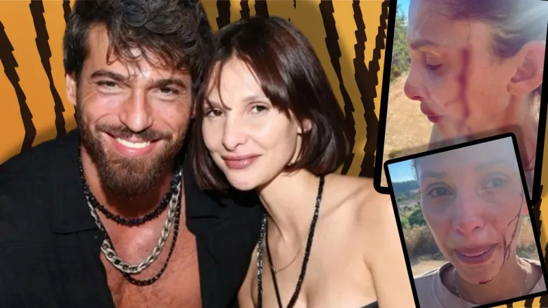 Can Yaman’ın sevgilisi Sara Bluma'dan olay ifşa: Şiddet gördüğünü açıkladı!