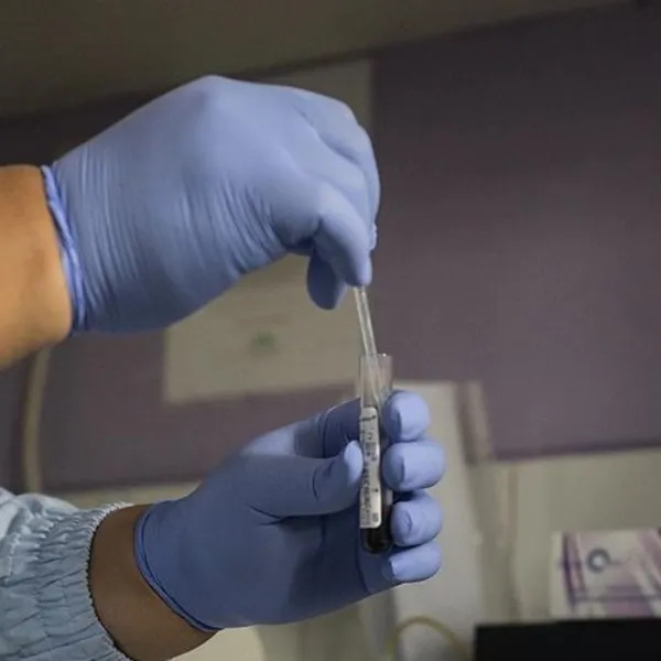 AIDS Alarmı! DSÖ'den Korkutan Rapor: 2024'te Kaç Kişi Yakalandı?