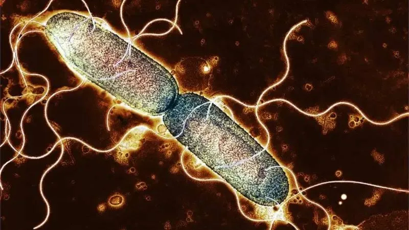 "Salmonella, bahar ve yaz aylarını seviyor"